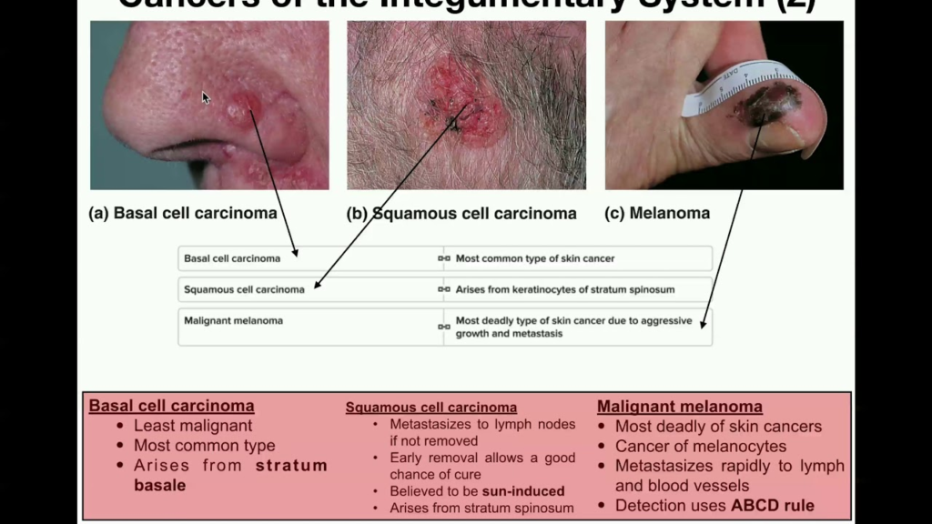 This image has an empty alt attribute; its file name is image-20-1024x576.png